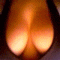 docLEXfisti
