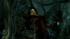 Mortal Kombat_Freddy Krueger